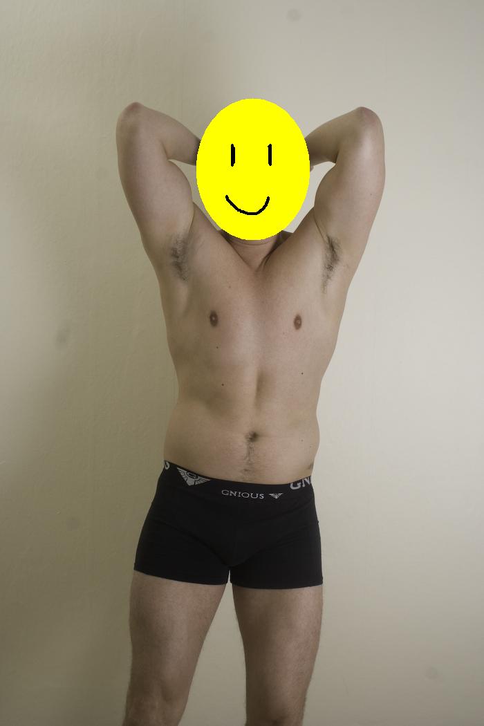 Billede