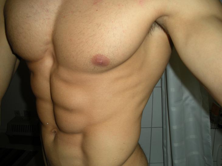Billede