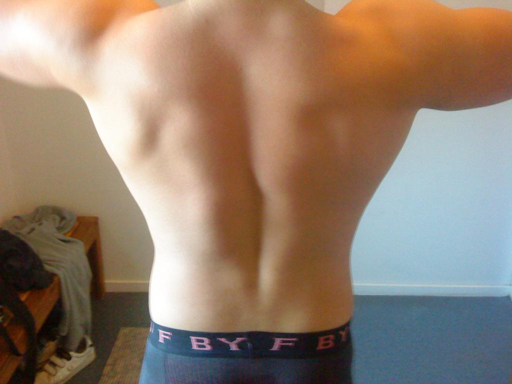 Billede