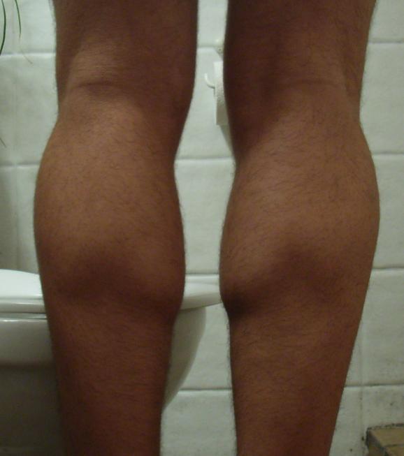 1851-calves.jpg