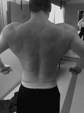 4281-Marcback091107.jpg
