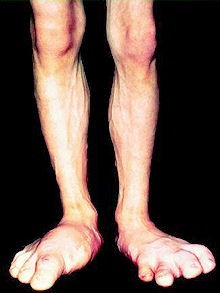 5724-growth_hormone3.jpg