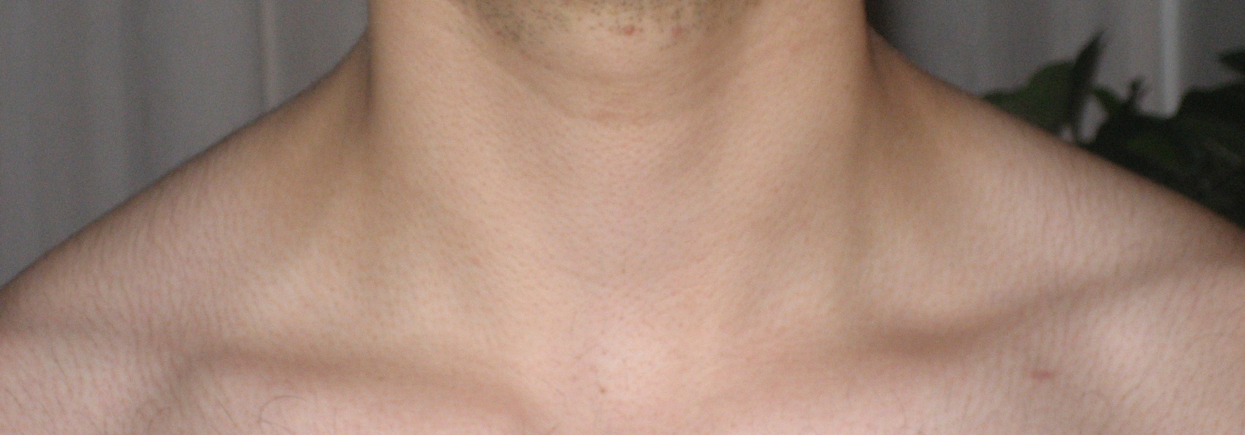 5835-Afslappet nakke.JPG