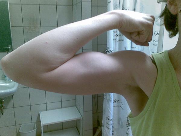 6207-arm.JPG