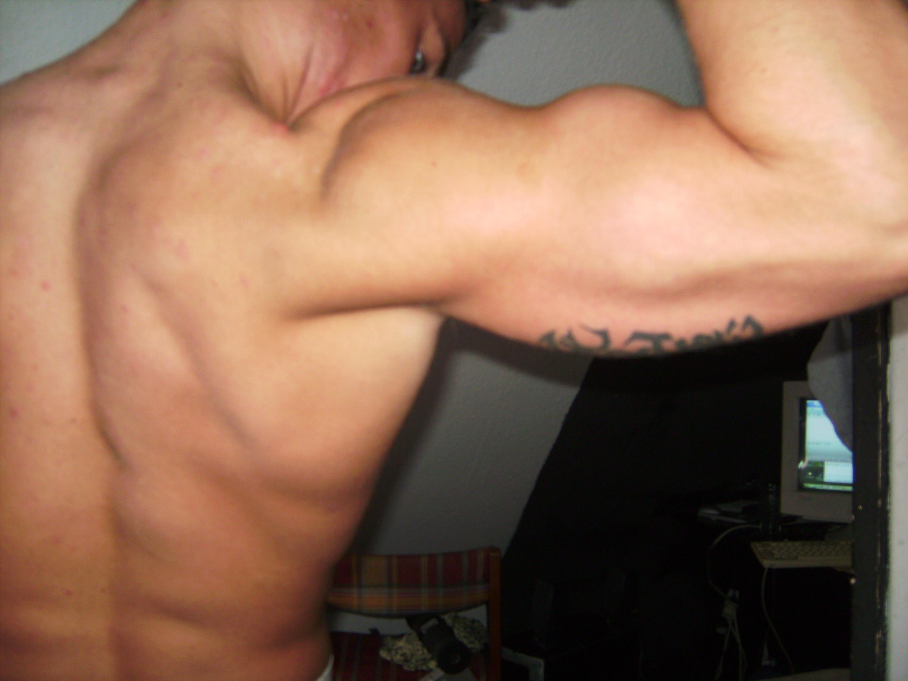 2751-rygarm1.JPG
