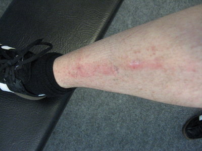 marks of pride.jpg