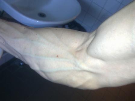 veins.jpg