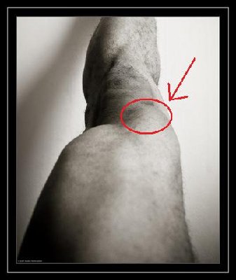 leg.jpg
