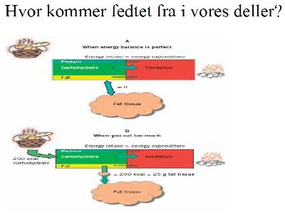 Fedtdeponering.jpg