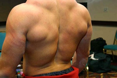 Epic back sl.jpg