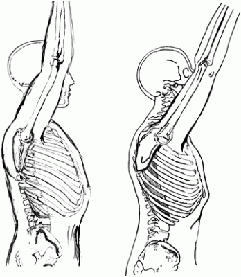 figure-1.gif