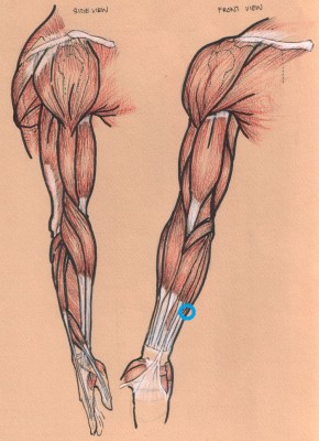 arm.jpg