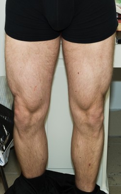 Legs_8_weeks.jpg