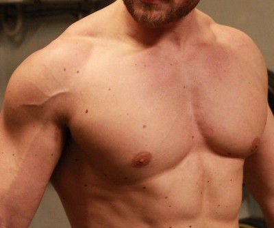 Thick shoulder veins.jpg