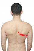 shoulderbladepain.png