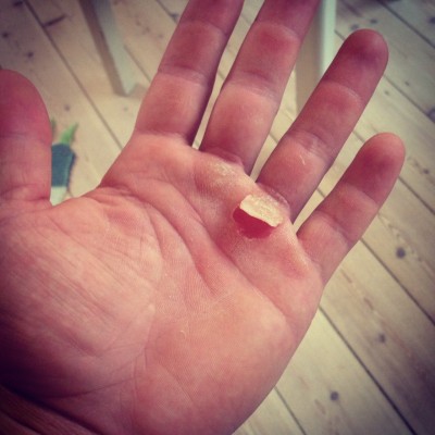 markus callus tear.JPG