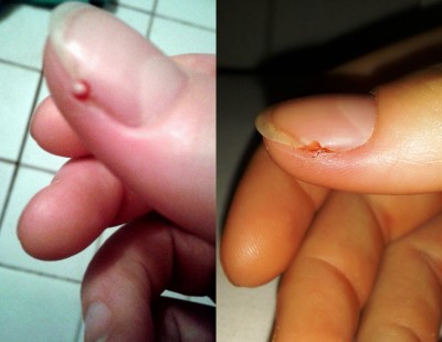 Finger.jpg