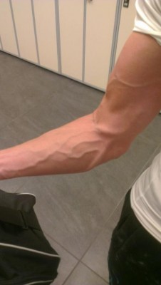 Veins September.jpg