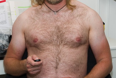Front_before.jpg