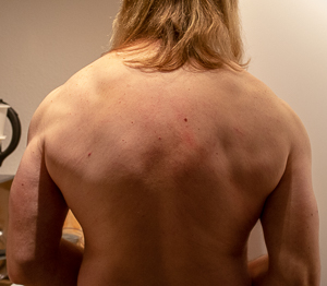 Back_86_0_kg_20181223_diet_week_9_small.jpg