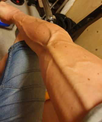 Veins1.jpg