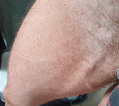 benveins.jpg