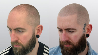 before-and-after-12.jpg