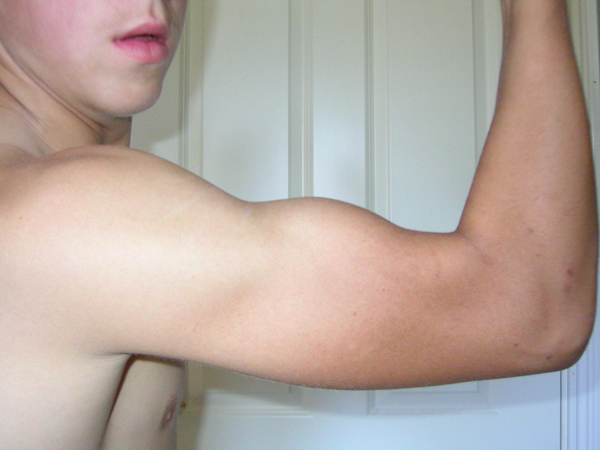 2686-H-biceps D.28-07 005.jpg