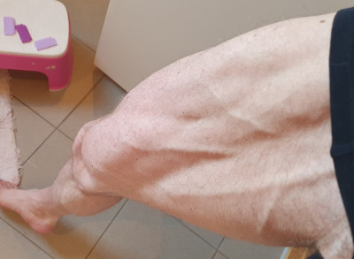 Ben veins 2020 redigeret.jpg